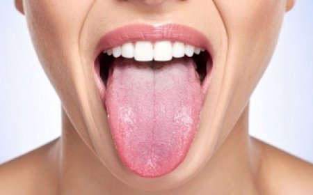 त्रिदोष के असंतुलन का संकेत देती है जीभ, रंग से पहचाने शरीर के विकार